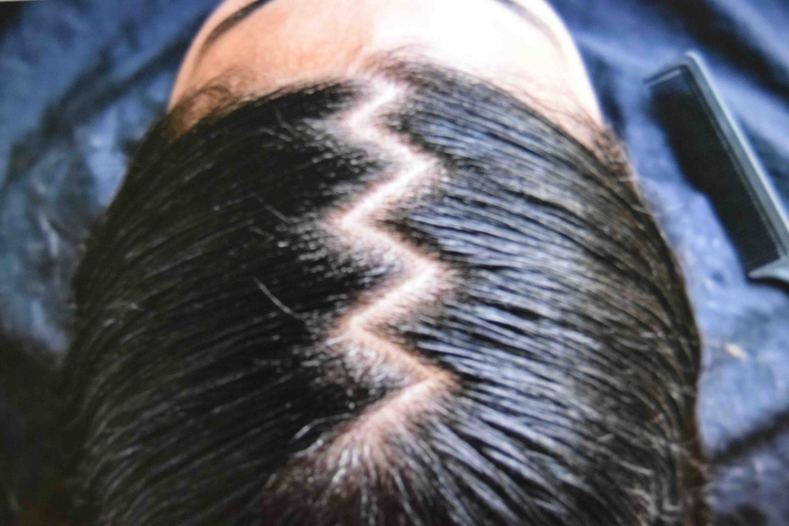 Zig-zag parting combed across the scalp before splitting into two ponytails
