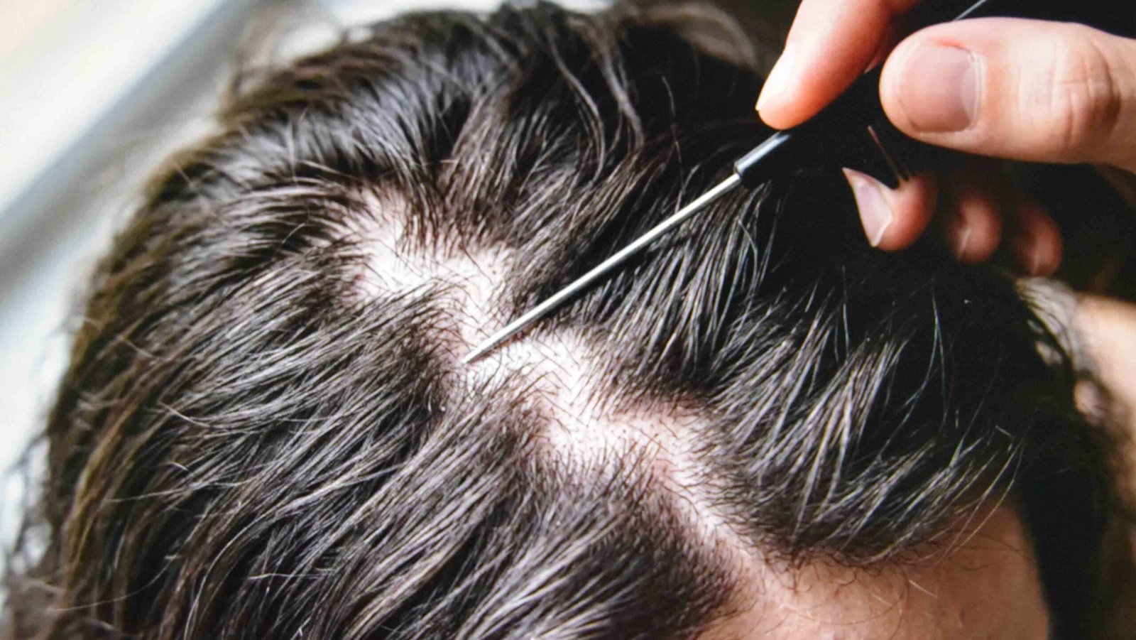 Switching the part with a comb as a way to fix oily hair without washing