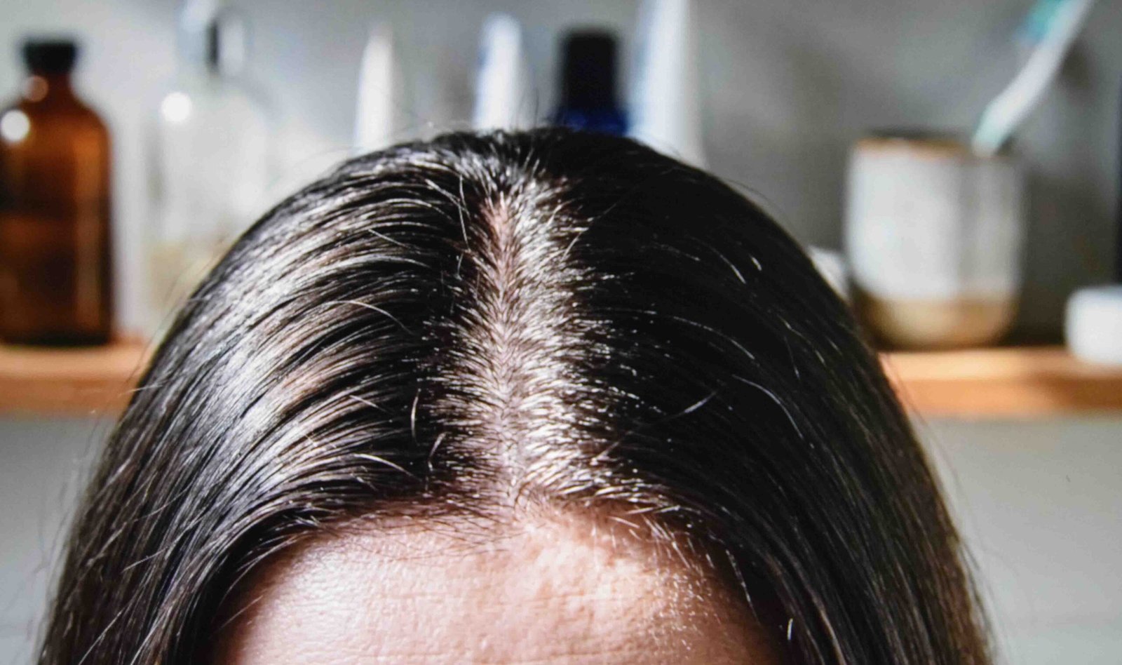 A close look at the scalp explaining what causes oily hair at the root